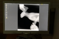 Новый рентген в Ступино